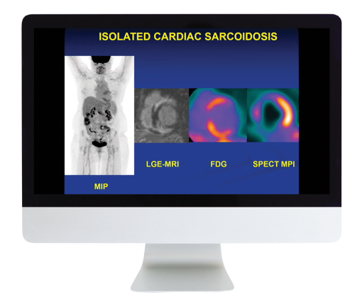 Case Review of Nuclear Medicine