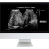 Case Review of Ultrasound