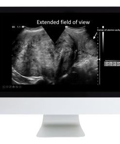 Case Review of Ultrasound