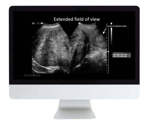 Case Review of Ultrasound