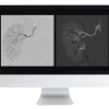 Case Review of Vascular and Interventional Radiology