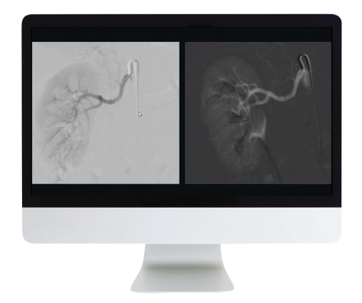 Case Review of Vascular and Interventional Radiology