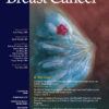 Clinical Breast Cancer Volume 24, Issue 2