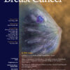 Clinical Breast Cancer PDF