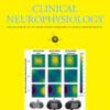 Clinical Neurophysiology Volume 158