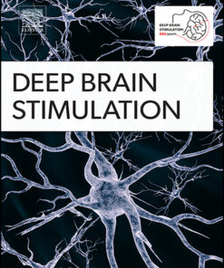 Deep Brain Stimulation PDF