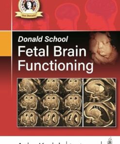 Donald School Fetal Brain Functioning 1st Edition (PDF)