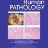 Human Pathology Volume 143