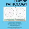 Human Pathology Volume 144