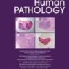 Human Pathology PDF