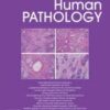 Human Pathology PDF