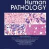 Human Pathology PDF