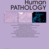 Human Pathology PDF