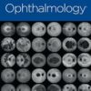 Ophthalmology PDF