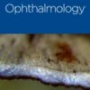 Ophthalmology PDF