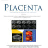 Placenta Volume 145