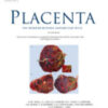 Placenta Volume 146