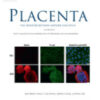 Placenta Volume 147