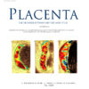 Placenta Volume 148