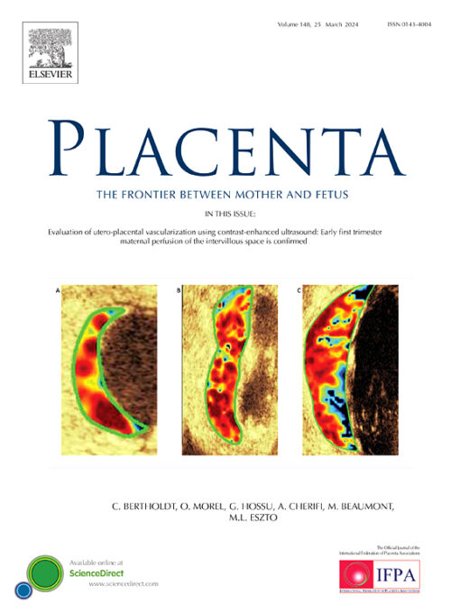 Placenta PDF