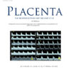 Placenta PDF