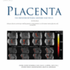 Placenta PDF