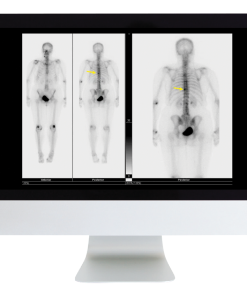 Procedures 101 for the General Radiologist