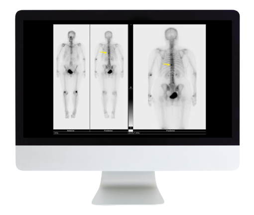 Procedures 101 for the General Radiologist