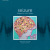 Seizure European Journal Of Epilepsy Volume 115