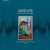 Seizure: European Journal of Epilepsy PDF