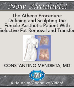 The Athena Procedure: Defining and Sculpting the Female Aesthetic Patient With Selective Fat Removal and Transfer 2024