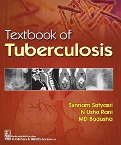 Textbook Of Tuberculosis (PDF)