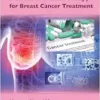 Novel Approaches In Metronomic Chemotherapy For Breast Cancer Treatment (EPUB)