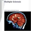 Fast Facts: Multiple Sclerosis, 5th Edition (PDF)