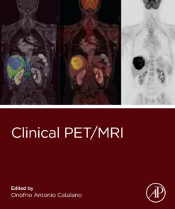 Clinical PET/MRI (EPUB)