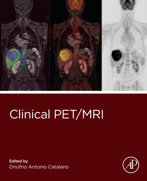 Clinical PET/MRI (EPUB)