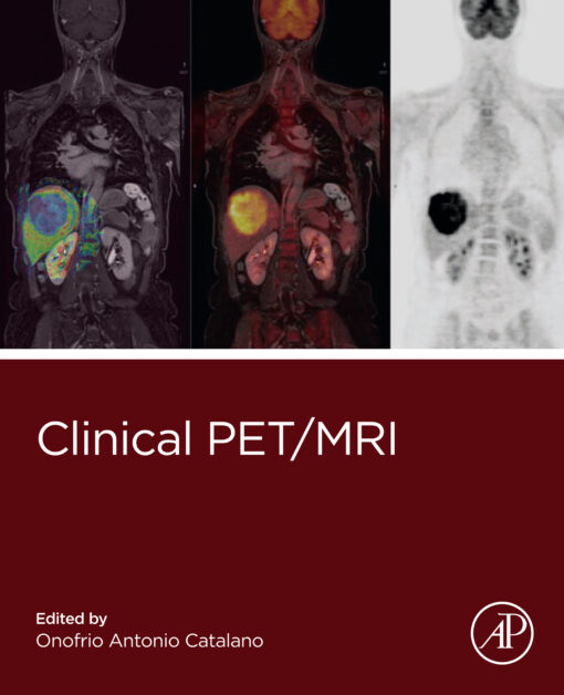 Clinical PET/MRI (PDF)