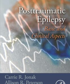 Posttraumatic Epilepsy: Basic And Clinical Aspects (EPUB)