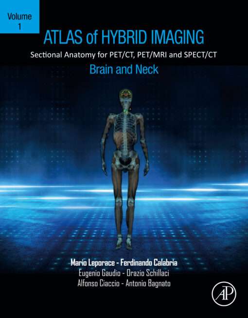 Atlas Of Hybrid Imaging Sectional Anatomy For PET/CT, PET/MRI And SPECT/CT Vol. 1: Brain And Neck: Sectional Anatomy For PET/CT, PET/MRI And SPECT/CT (EPUB)