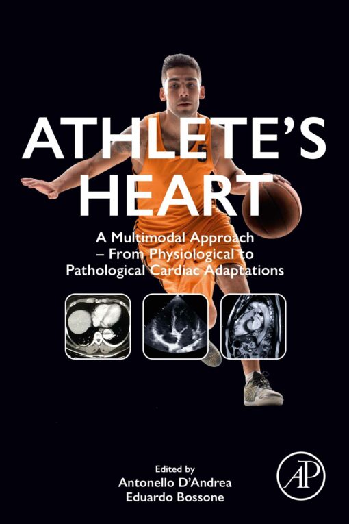 Athlete’s Heart: A Multimodal Approach – From Physiological To Pathological Cardiac Adaptations (PDF)