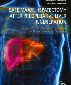 Safe Major Hepatectomy After Preoperative Liver Regeneration: Preopearative PVE, Two-Satage Hepatetomy, ALPPS And Hepatic Vein Deprivation (PDF)