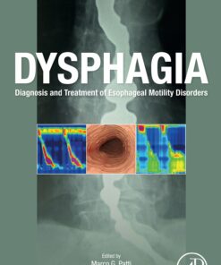 Dysphagia: Diagnosis And Treatment Of Esophageal Motility Disorders (EPUB)