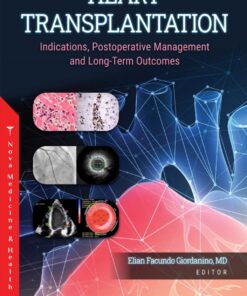 Heart Transplantation: Indications, Postoperative Management And Long-Term Outcomes (PDF)