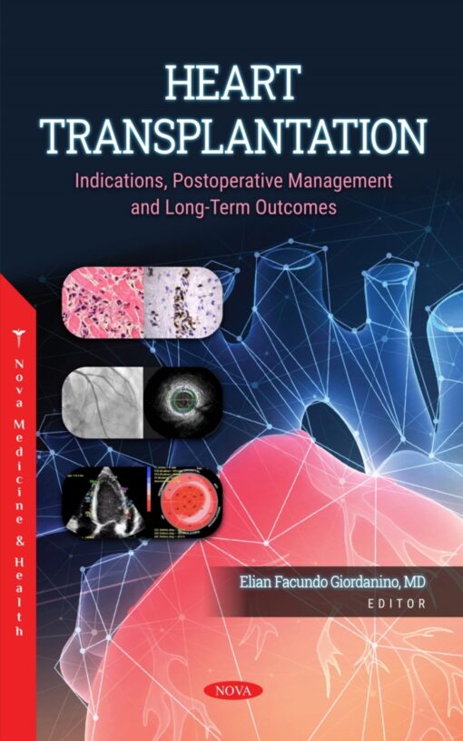 Heart Transplantation: Indications, Postoperative Management And Long-Term Outcomes (PDF)