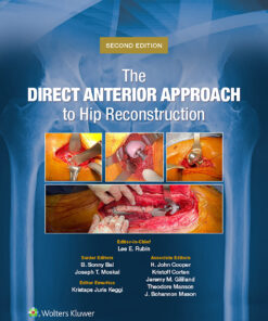 The Direct Anterior Approach to Hip Reconstruction, 2nd Edition  (EPUB)