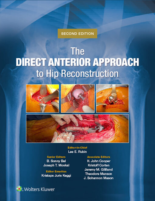 The Direct Anterior Approach to Hip Reconstruction, 2nd Edition  (EPUB)