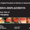 Single Surgical Procedures in Obstetrics and Gynaecology 15: A Colour Atlas of Cervicopexy (Purandare s): Single Surgical Procedures In Obs &Gyne 1st Edition (PDF)