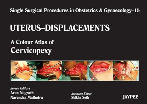 Single Surgical Procedures in Obstetrics and Gynaecology 15: A Colour Atlas of Cervicopexy (Purandare s): Single Surgical Procedures In Obs &Gyne 1st Edition (PDF)