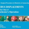 Uterus Displacements: A Colour Atlas of Manchester’s Operation (Single Surgical Procedures in Obstetrics and Gynaecology) 1st Edition (PDF)