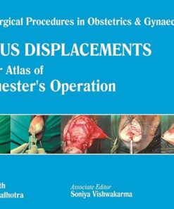 Uterus Displacements: A Colour Atlas of Manchester’s Operation (Single Surgical Procedures in Obstetrics and Gynaecology) 1st Edition (PDF)